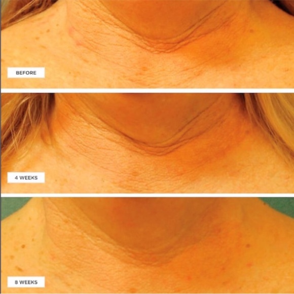 🆕 Perricone MD Cold Plasma+ Neck & Chest Broad Spectrum SPF 25 • Large 30ml - Picture 13 of 15